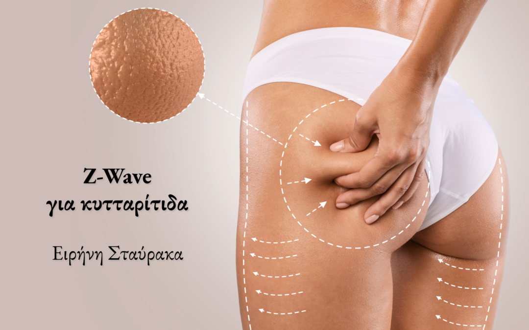 Z-Wave για κυτταρίτιδα – Πώς τα ακουστικά κύματα βελτιώνουν την όψη του δέρματος